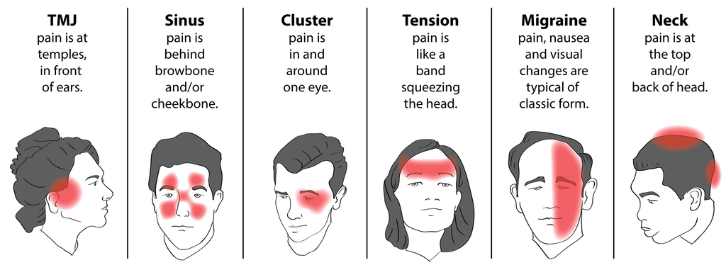 what causes headaches behind the eyes