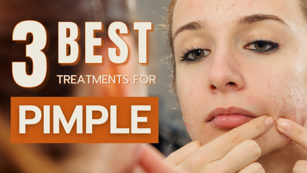 3 Best Treatments For Pimples What Are Pimples? Holistic Health HQ